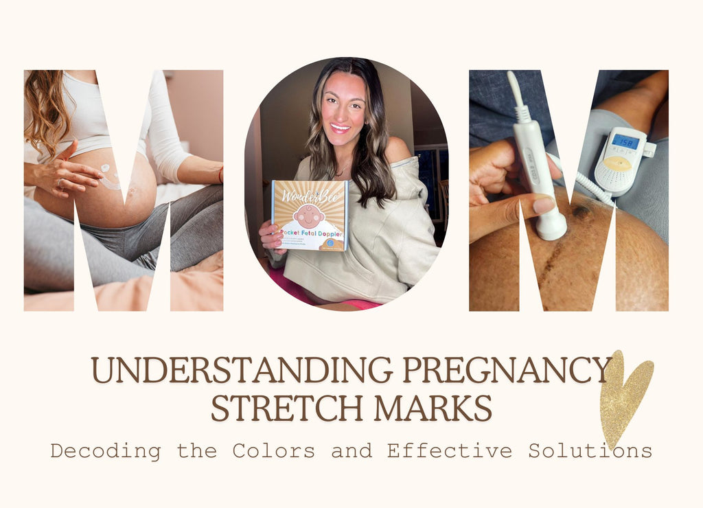 Understanding Pregnancy Stretch Marks: Decoding the Colors and Effective Solutions
